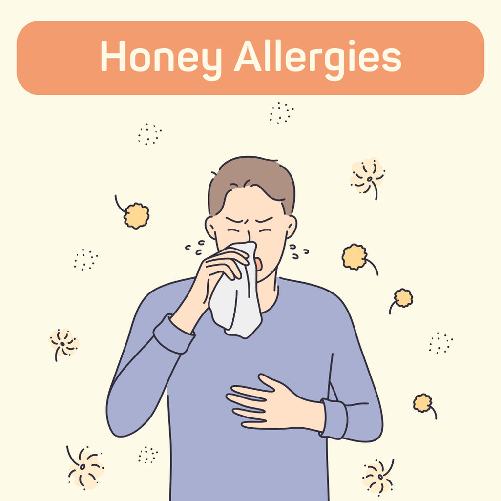 Honey Allergy Symptoms